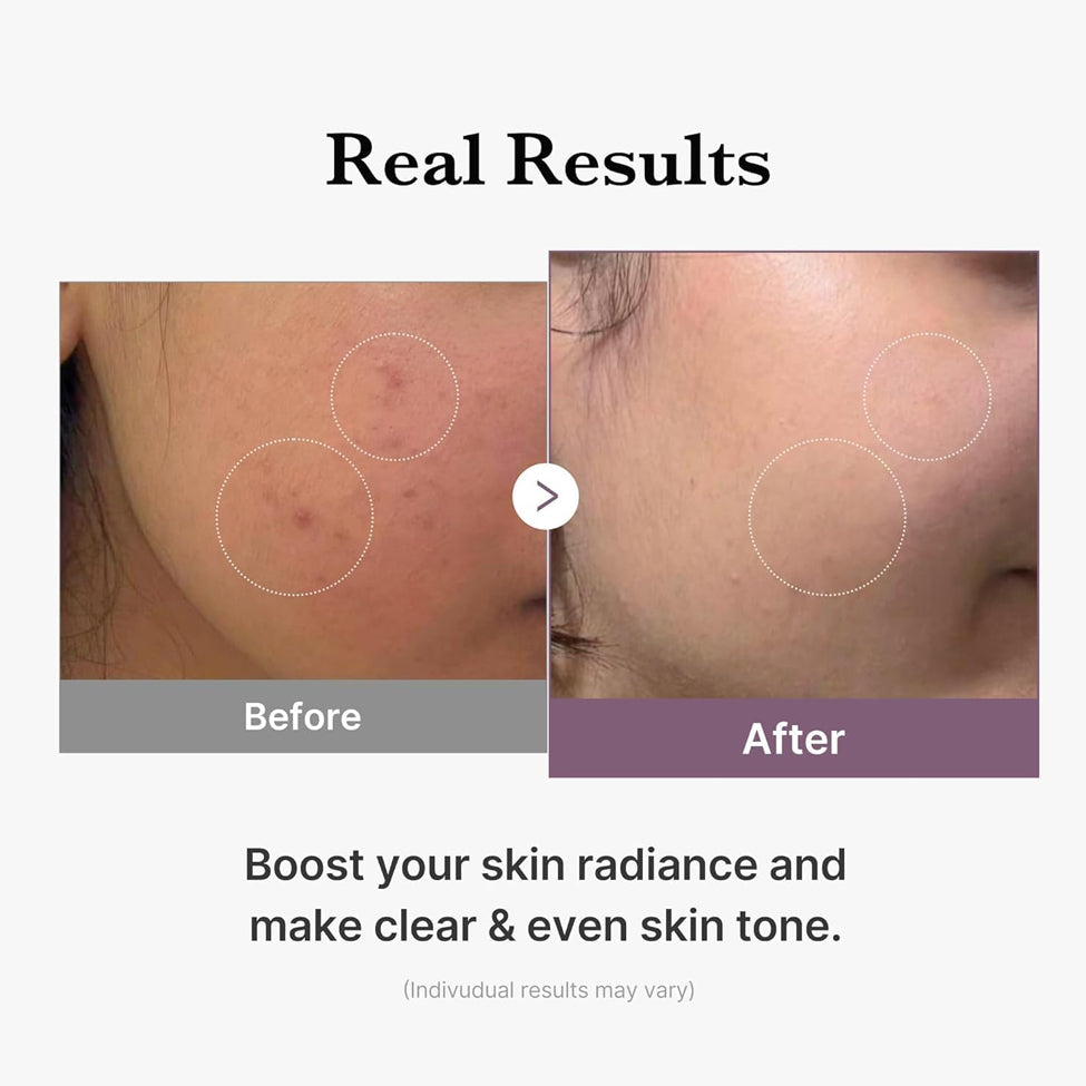 تونر AGE-R جلو بالغلوتاثيون لتفتيح وإشراقة البشرة 140 مل من ميديكيوب